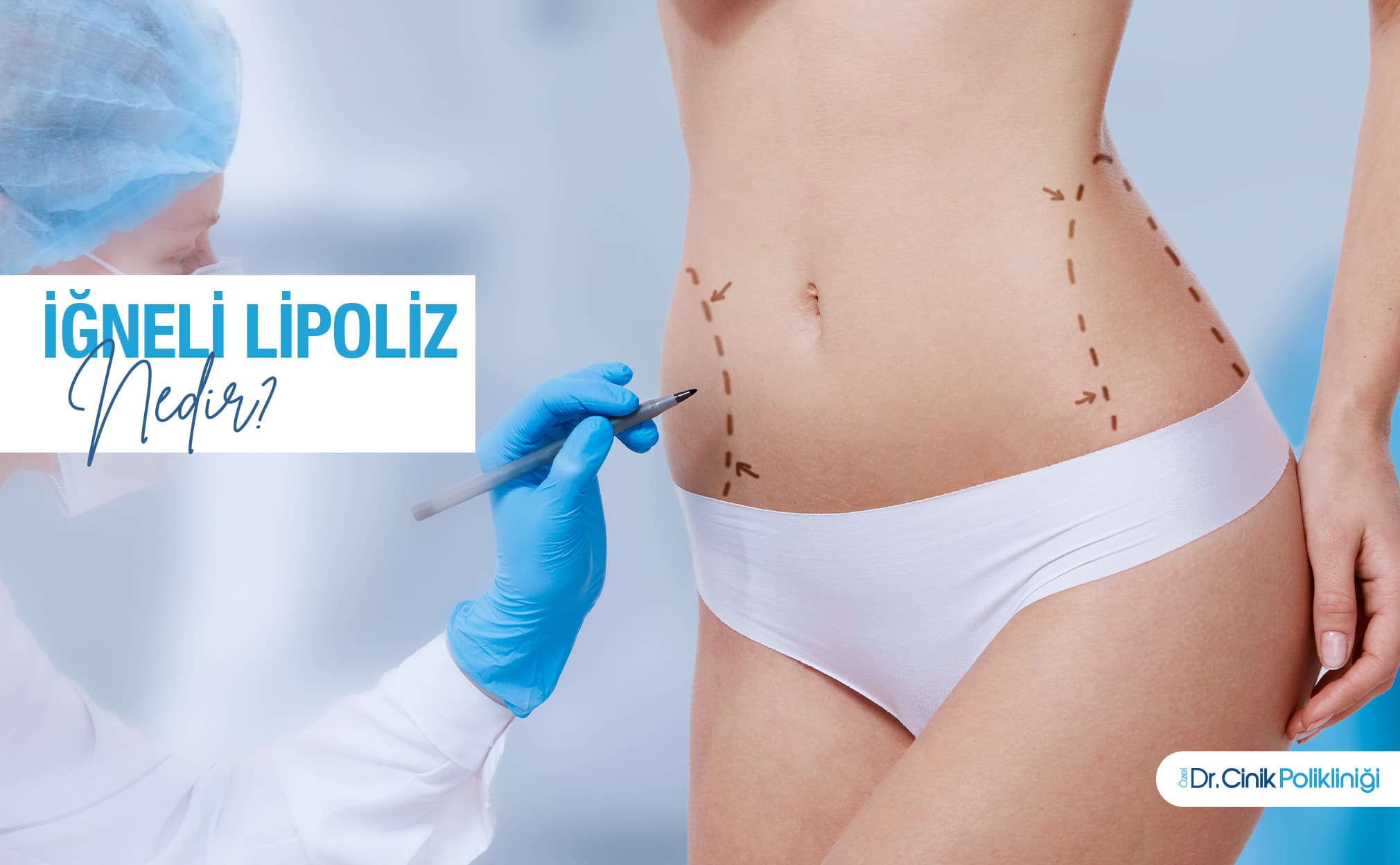 İğneli Lipoliz Nedir ve Estetik Tıpta Neden Bu Kadar Önem Kazanmıştır?
