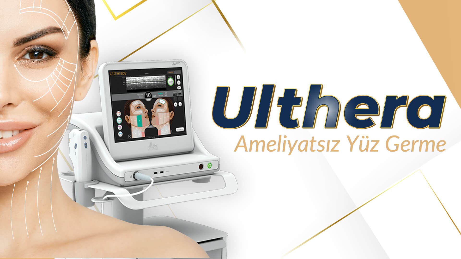 Ulthera Nasıl Uygulanır?