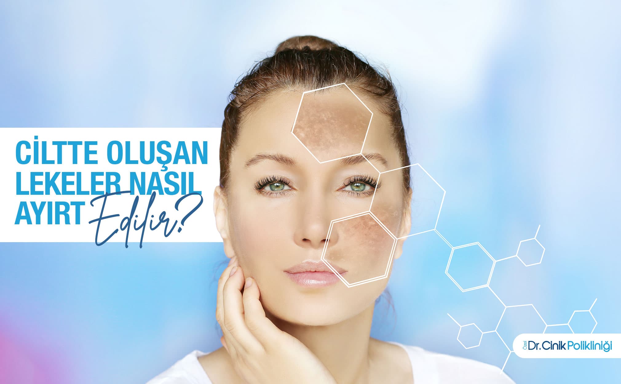 Ciltte Oluşan Lekeler Nasıl Ayırt Edilir? Bilimsel ve Klinik Bir Yaklaşım