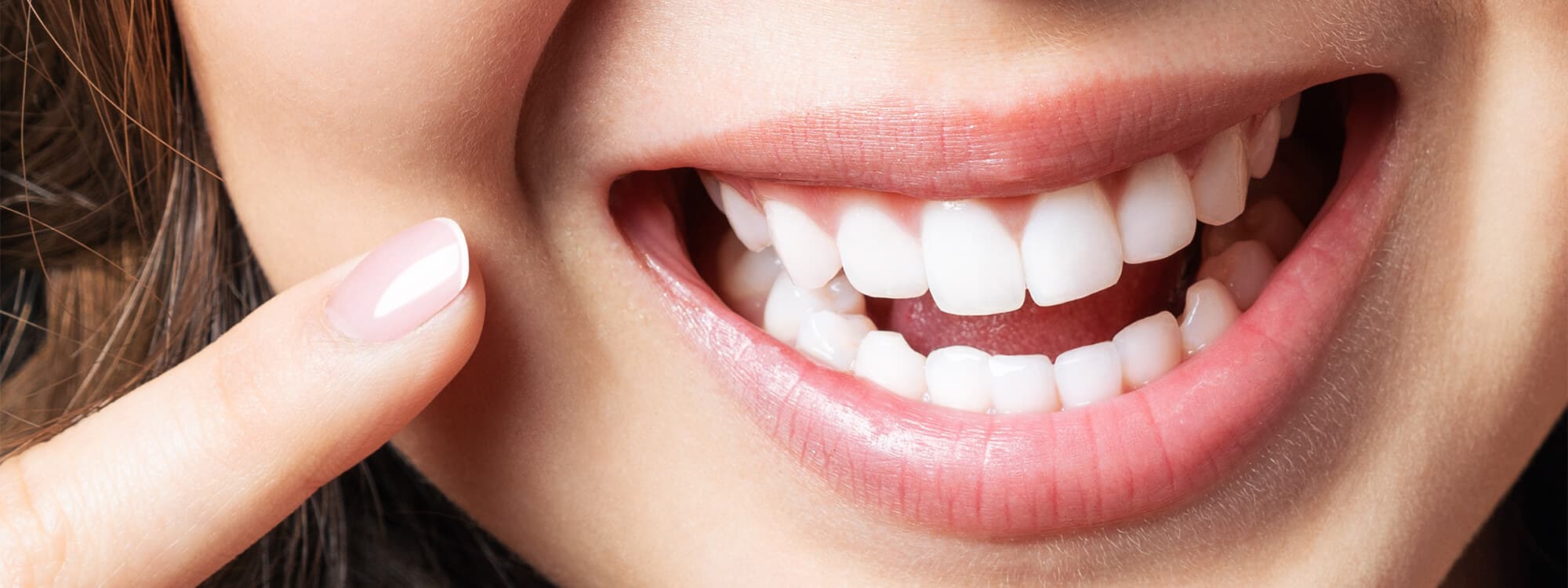 Diş Eti Estetiği(Gummy Smile)