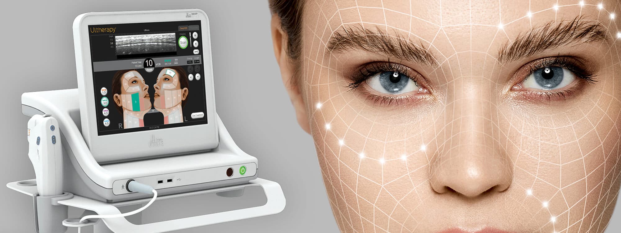 Ulthera (Ultherapy)
