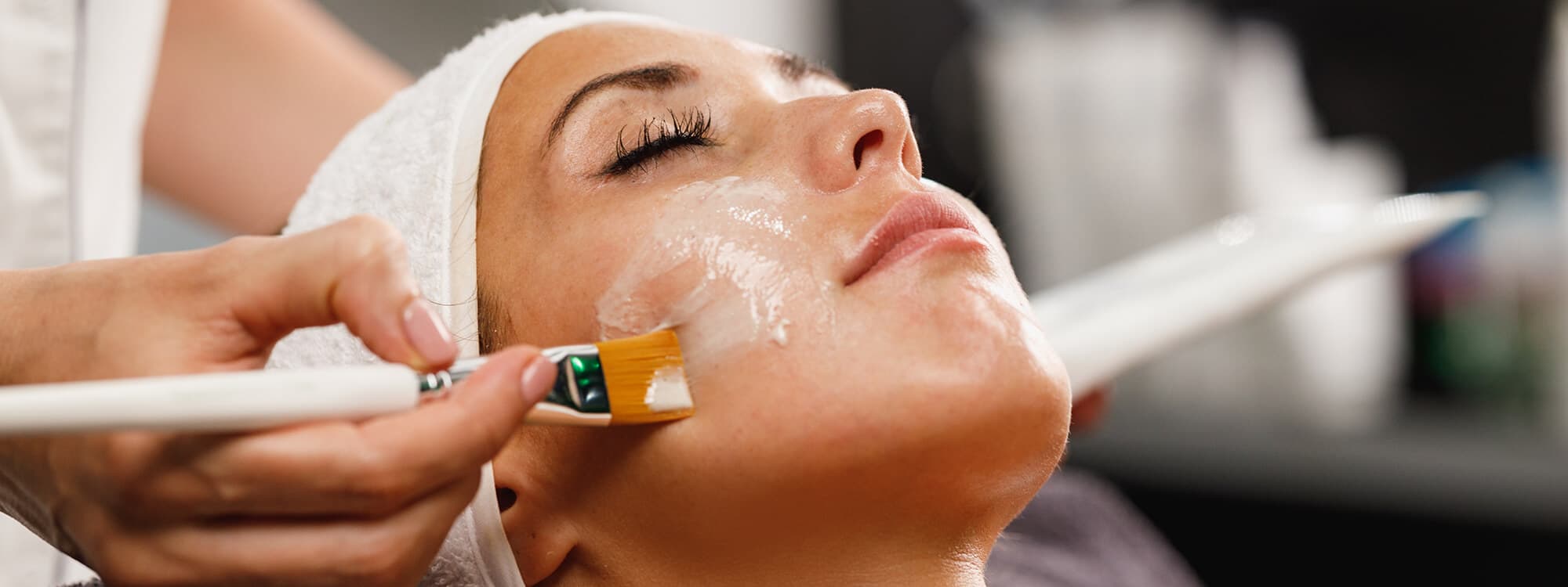Kimyasal Peeling
