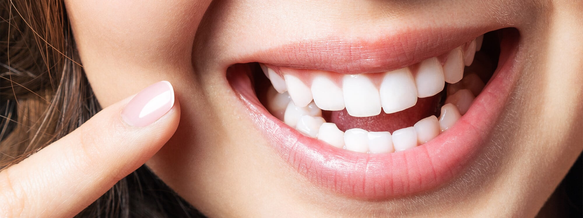 Diş Eti Estetiği(Gummy Smile)