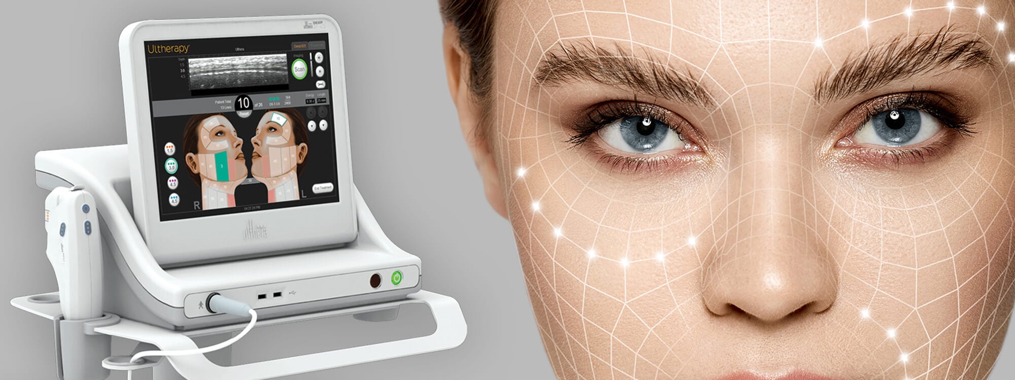 Ulthera(Ultherapy)